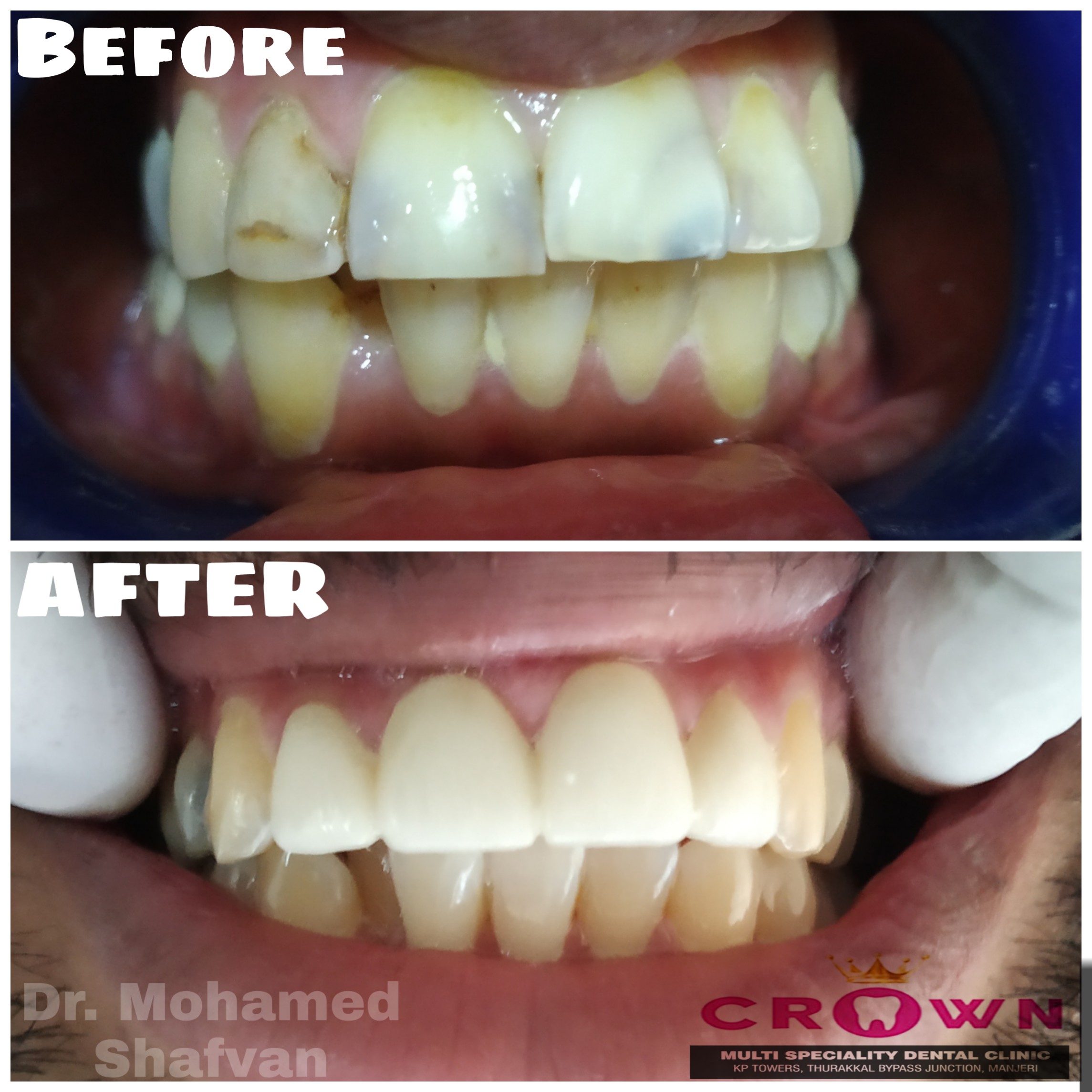 Crown Multi speciality Dental clinic