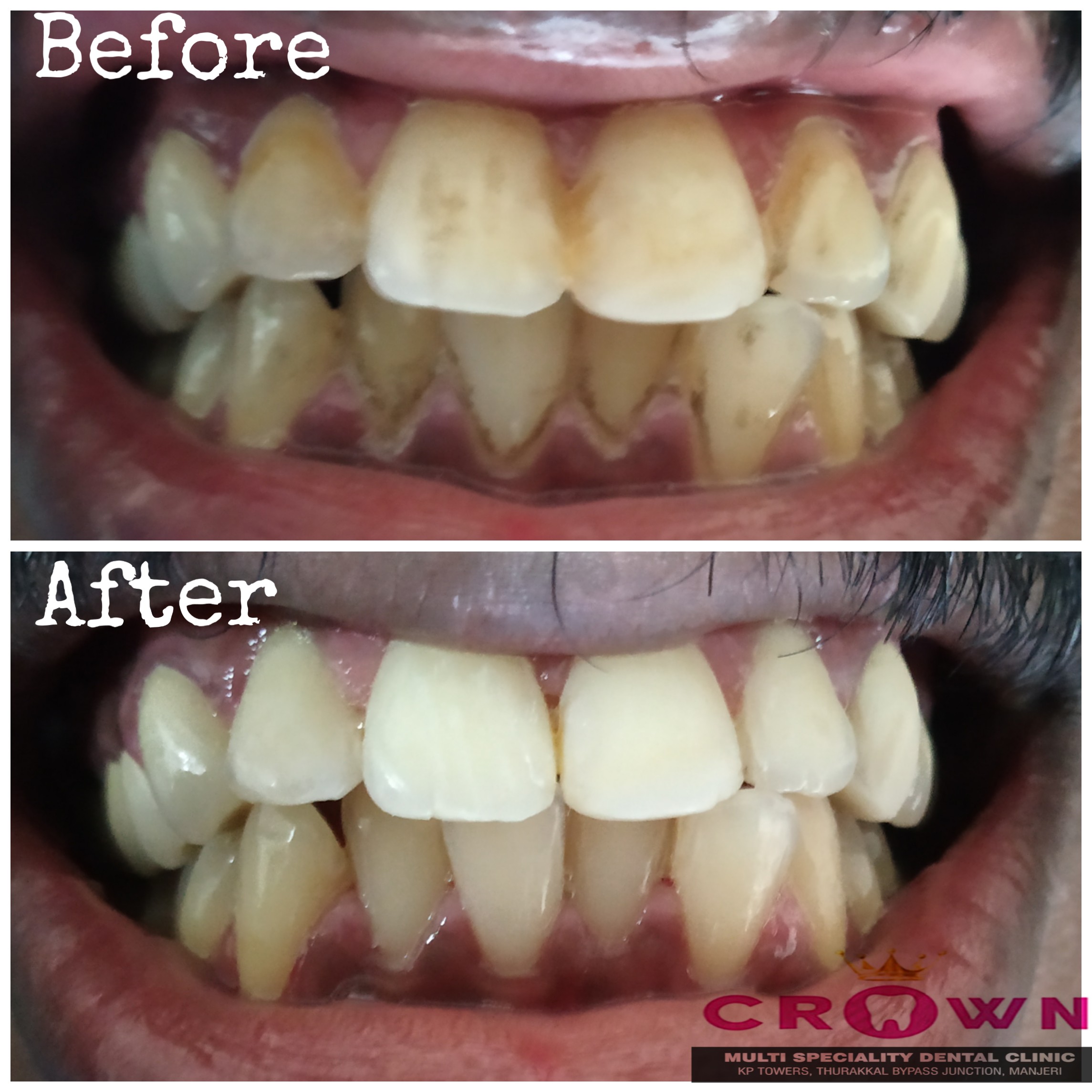 Crown Multi speciality Dental clinic