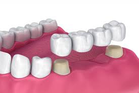 Crown Multi speciality Dental clinic