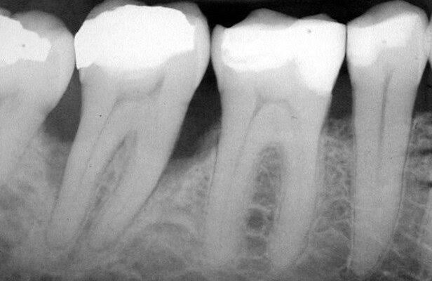 Crown Multi speciality Dental clinic